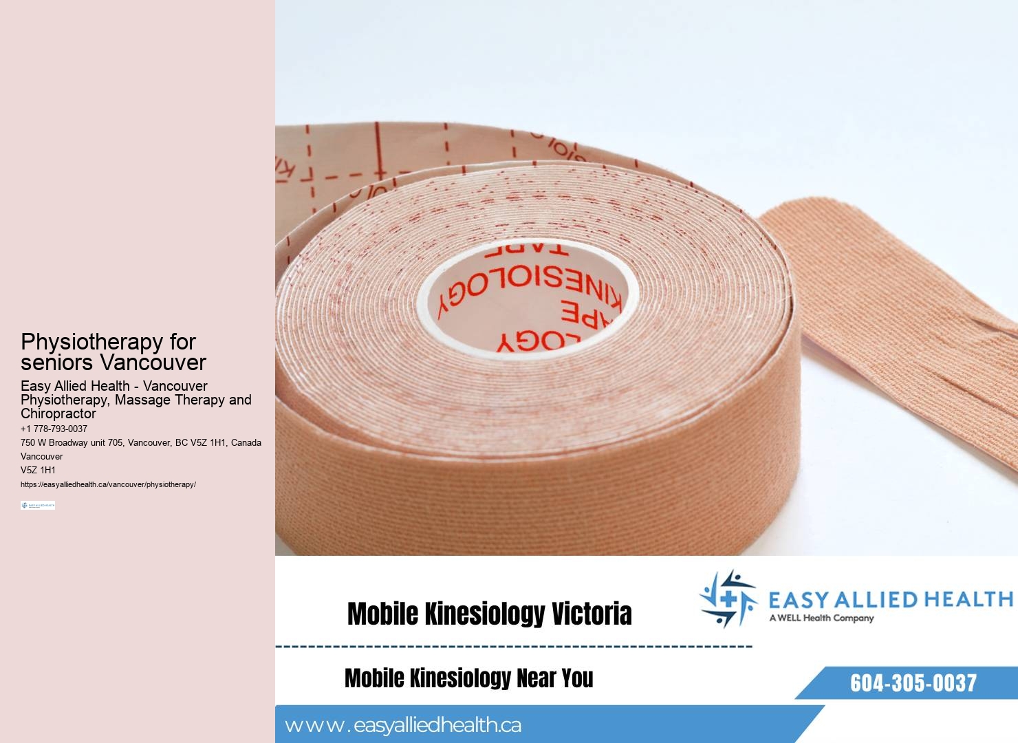 Vancouver physiotherapy for sciatica