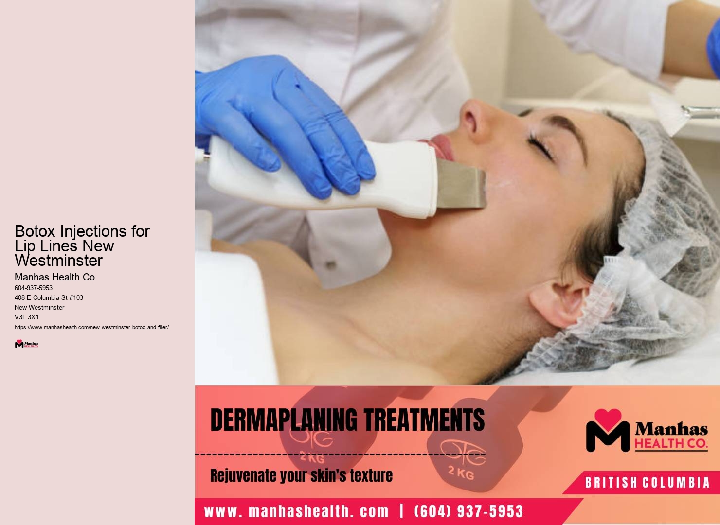 Botox for Vertical Lip Lines in New Westminster