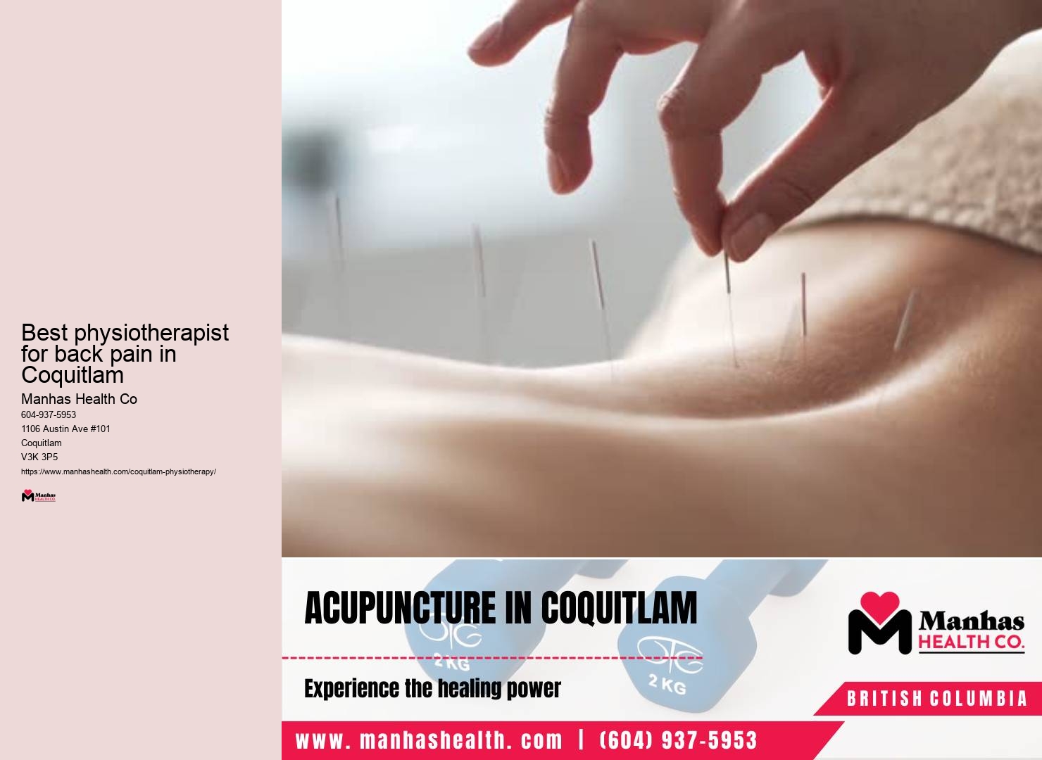 Local physiotherapy services Best physiotherapist for back pain in Coquitlam